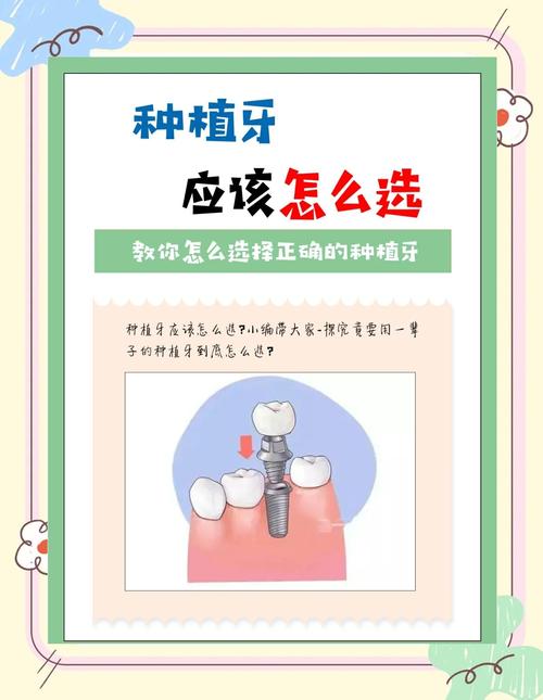 重庆满口种牙别担心 医生告诉你真相和选择