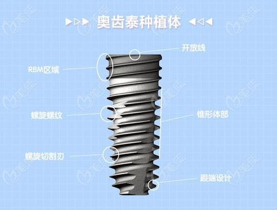 重庆常州百康特种植牙多少钱？本地人都在问的价格明细