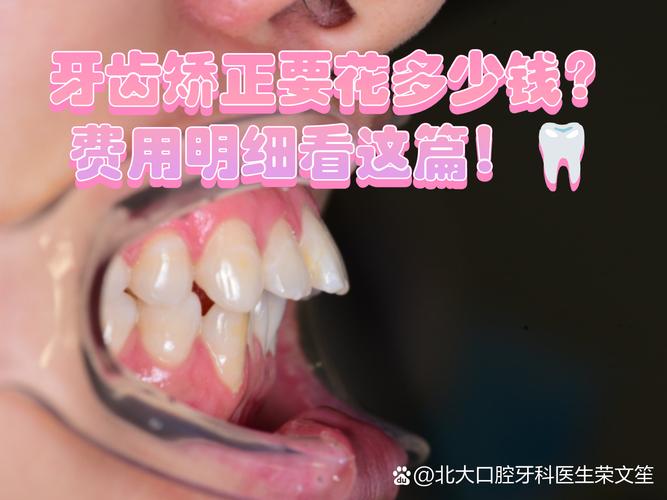 重庆广州牙齿矫正到底要花多少钱？看完这篇不踩坑