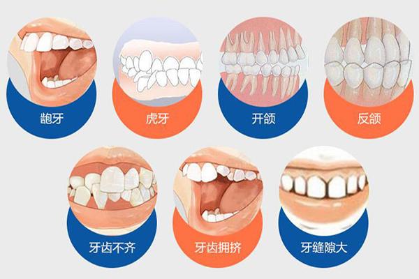 重庆合肥隐形牙齿矫正费用贵不贵？要多少钱？