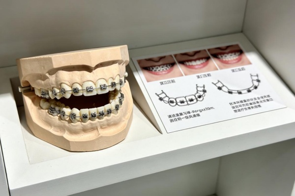 重庆2026矫正牙齿价格表｜从8k到8w，不同方式费用明细全解析