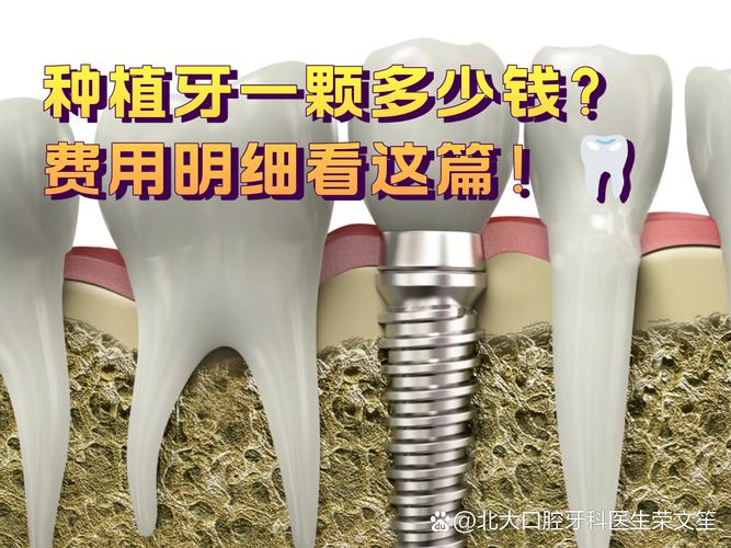 重庆2025年种牙一颗到底要花多少钱？看完这篇不踩坑