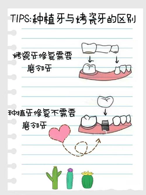重庆假牙和种植牙有什么区别 牙医告诉你哪种更划算
