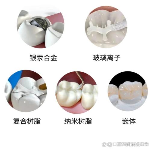 重庆补牙用什么材料好？哪种补牙材料最靠谱？