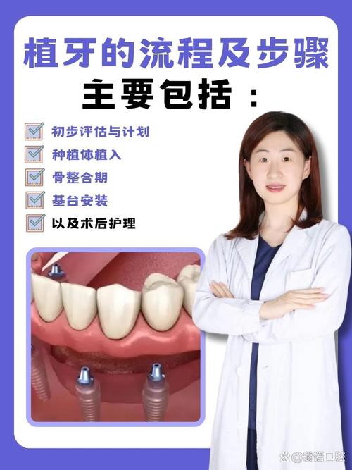 重庆登特口腔植牙怎么样 缺牙必看攻略