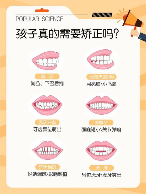 重庆宝宝地包天牙齿纠正要趁早