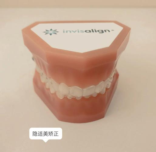 重庆深圳牙缝过大矫正多少钱 明细与避坑指南