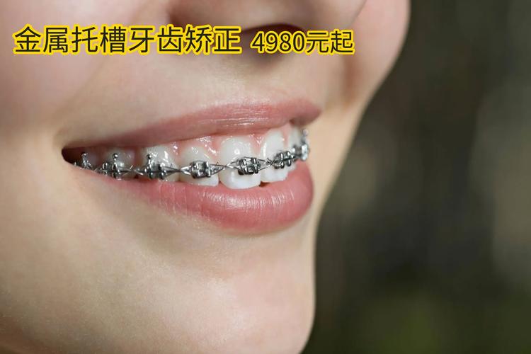重庆38岁还能做牙齿矫正吗 大龄正畸的真相与建议