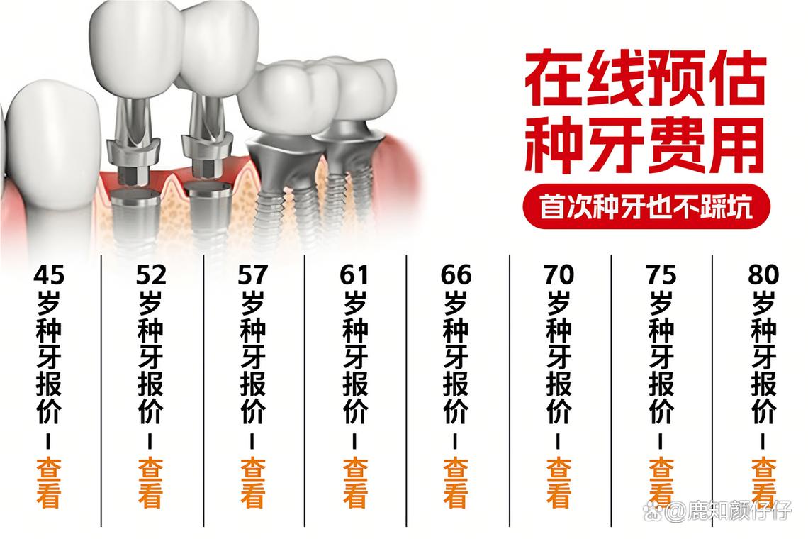 重庆深圳罗湖种牙哪家靠谱 诺贝尔种植牙医院怎么选