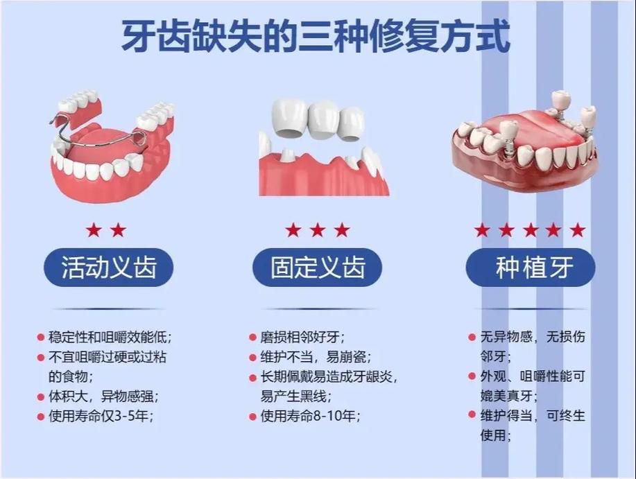 重庆缺牙不种牙还有哪些靠谱的修复方法