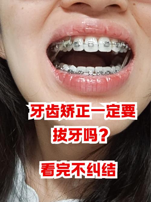 35岁做牙齿矫正_牙齿矫正做一半能放弃吗_牙齿矫正做哪种好
