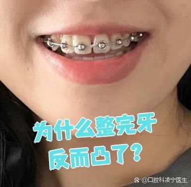 重庆牙齿不齐别担心 纠正牙齿的较佳年龄看这里
