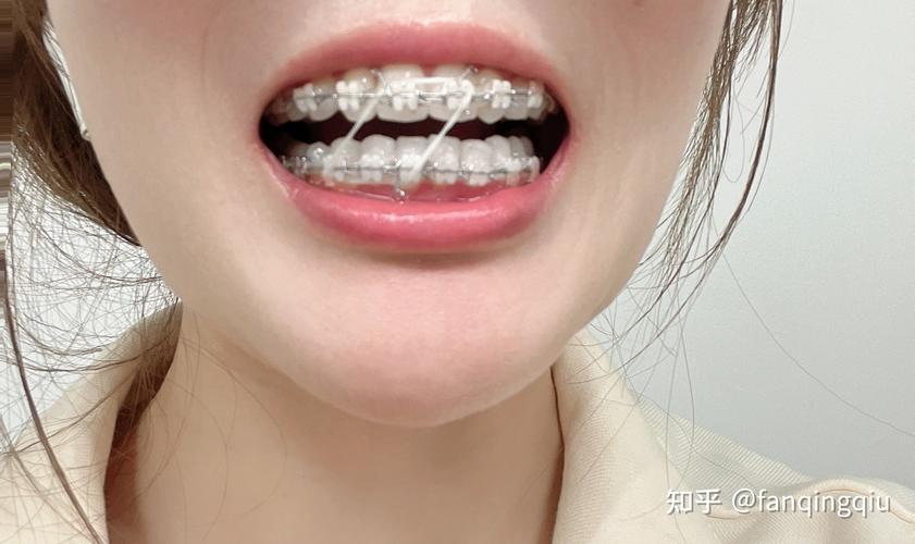 重庆27岁做牙齿矫正还来得及吗