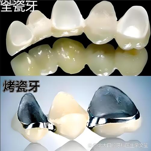 重庆天津种一颗牙要多少钱？看完这篇就懂了