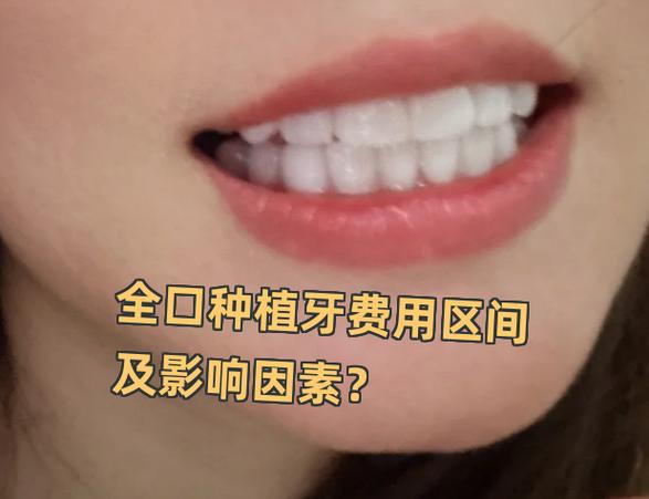 重庆深圳罗湖骨量不足全口种牙大概多少钱