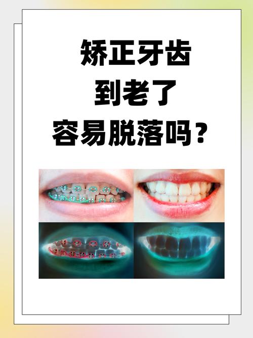 重庆43岁矫正牙齿晚不晚 过来人告诉你答案