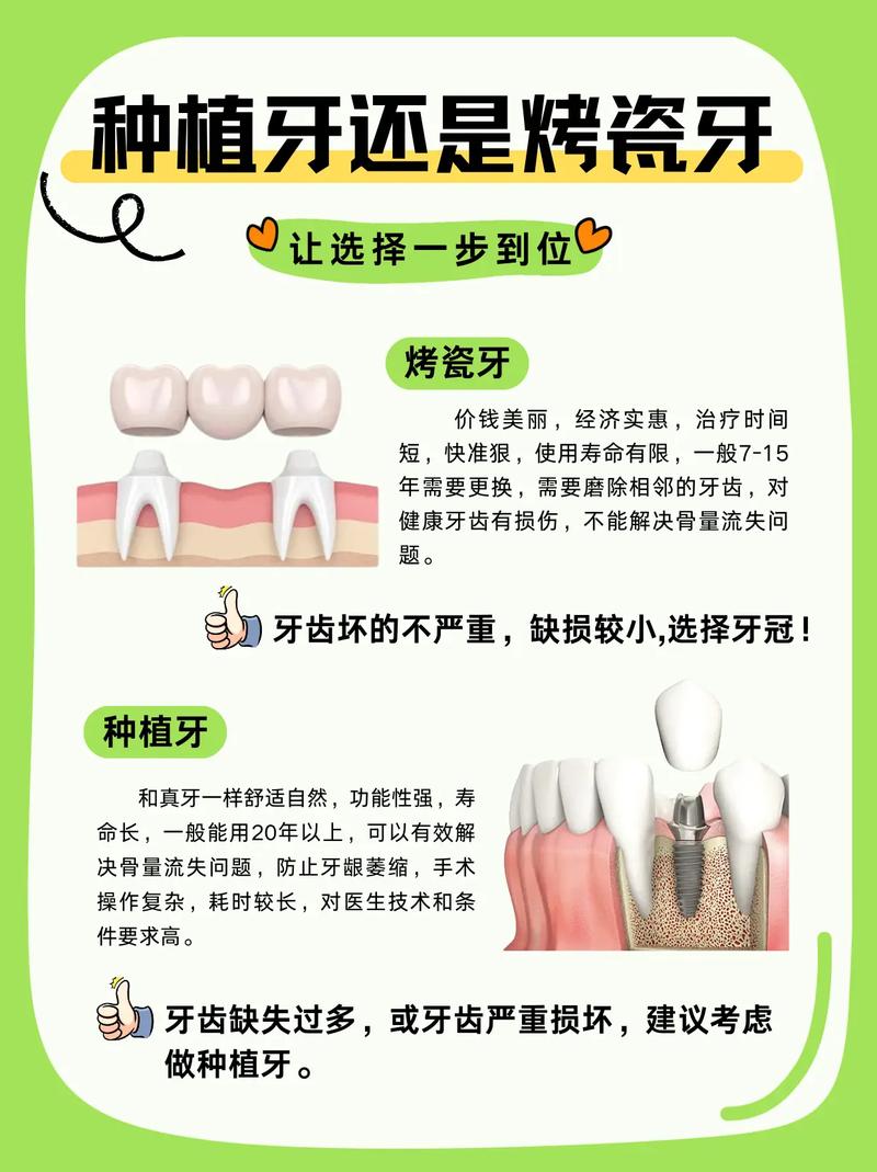 重庆烤瓷牙还是种植牙 牙医教你选对修复方式