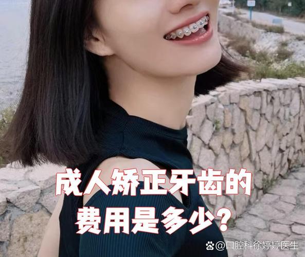 重庆隐形矫正牙齿前必看 效果费用全解析