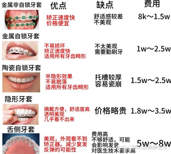 重庆深圳福田青少年做钢丝牙套大概要花多少钱？
