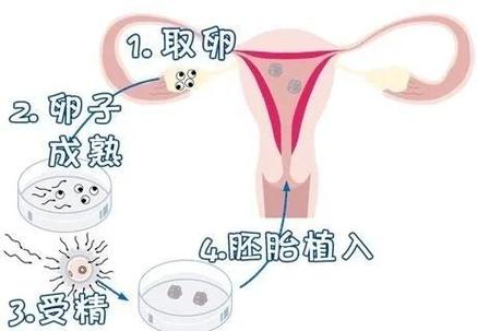 重庆第三代试管婴儿准备多少预算？这笔账你得算明白