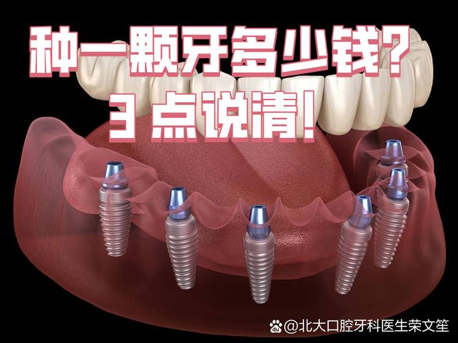 重庆沈阳种牙2026年单颗多少钱？3000到5200元能搞定吗