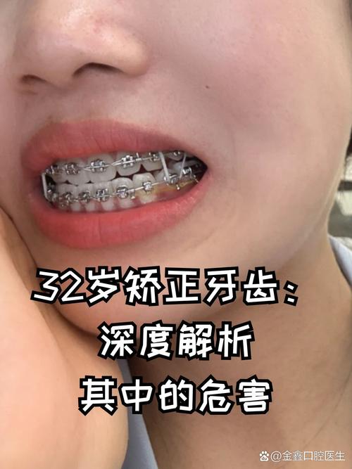 重庆30岁以后能矫正牙齿吗？三十岁矫正效果及最佳年龄解析