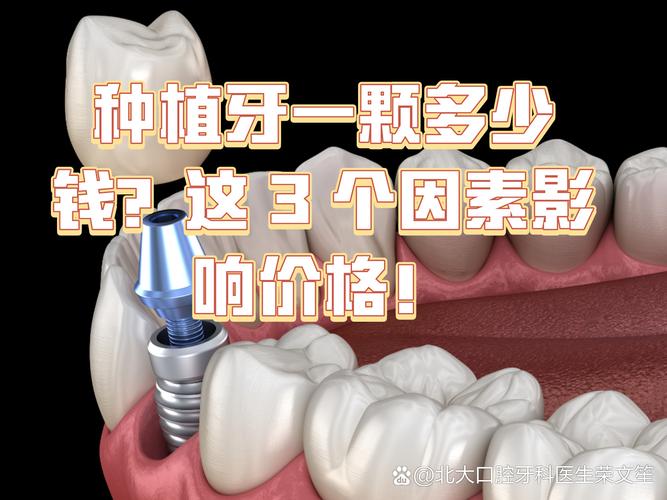 重庆镶一颗种牙要多少钱 影响种植牙费用的关键因素梳理