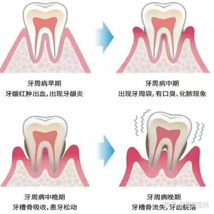 重庆三十岁还能整牙吗？成人牙齿矫正必知真相