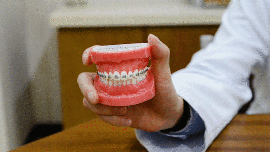 重庆深圳蛇口隐形矫正到底多少钱？2026年真实费用大揭秘