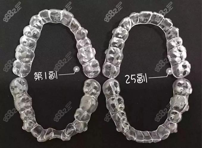 隐适美牙齿矫正价格_隐适美矫正费用明细_深圳隐适美隐形矫正价格明细