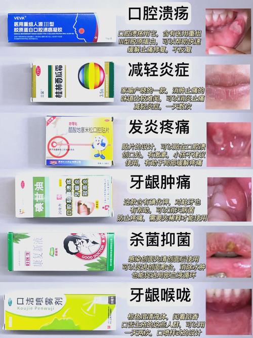 重庆小孩口腔溃疡吃什么好的快？收下这份家庭偏方与饮食指南，轻松缓解娃的疼痛