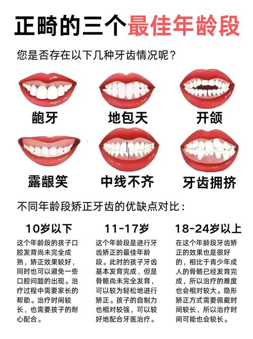 多大适合纠正牙齿_儿童多大纠正牙齿_多大纠正牙齿儿童可以做