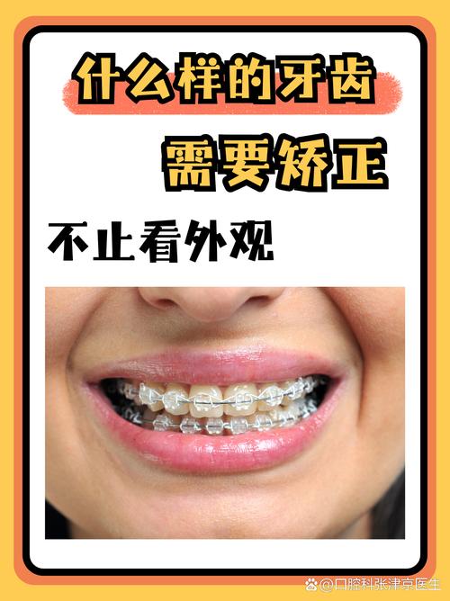 重庆45岁矫正牙齿还来得及吗？过来人分享3年真实经历，成人正畸必看