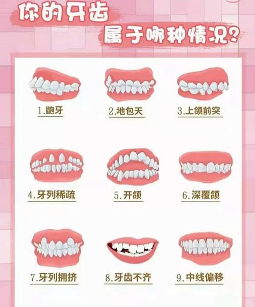 成人牙齿矫正畸形能矫正吗_成人牙齿矫正有什么危害_成人畸形牙齿怎么矫正