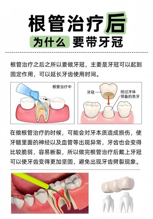 重庆根管治疗补牙到底怎么回事？医生详解步骤和必要性