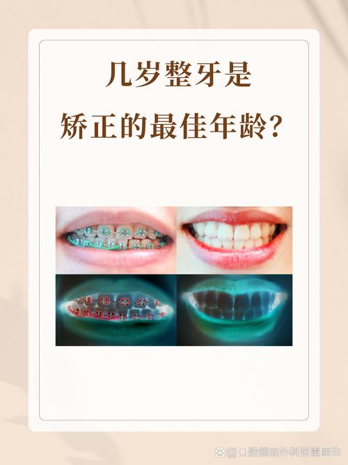 重庆60岁能做牙齿矫正吗 医生说实话：年龄不是问题，关键看这几点