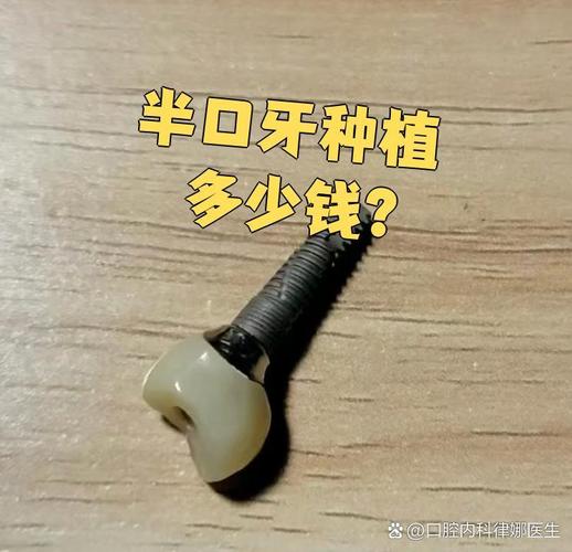 重庆深圳宝安半口种牙多少钱 中老年价格详解
