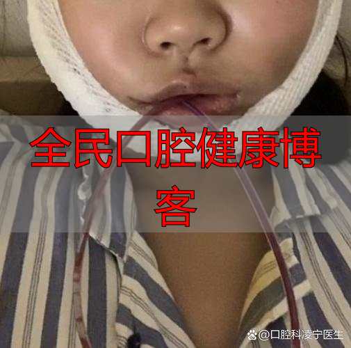 重庆口腔颌面部受伤啥特点？不只影响呼吸进食，感染风险也很高