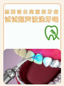 重庆自己用超声波洗牙安全吗？洗牙是医疗行为，别自己瞎搞