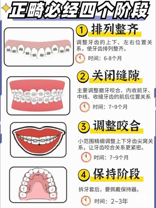 重庆成人牙齿矫正全攻略：30-40岁做还来得及吗？需要几年时间？