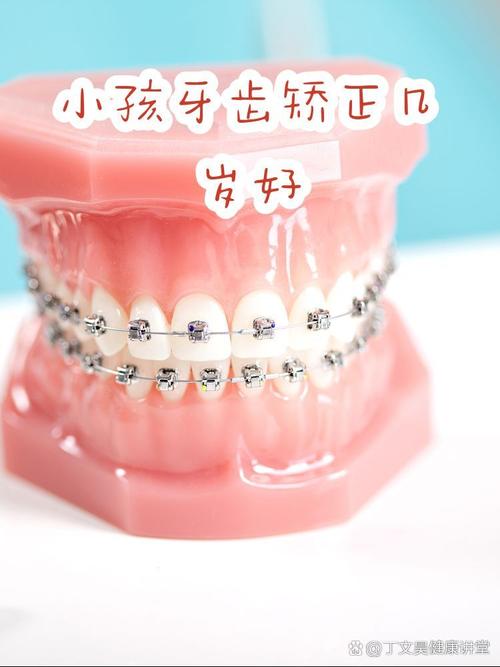 重庆16岁牙齿矫正晚吗？医生：抓住黄金期，效果一样好