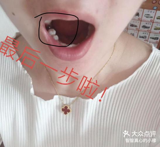 重庆宝安新安种植牙哪家医院好？真实体验告诉你