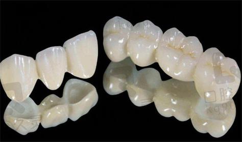 重庆深圳全瓷牙哪家牙科好 真实经验分享