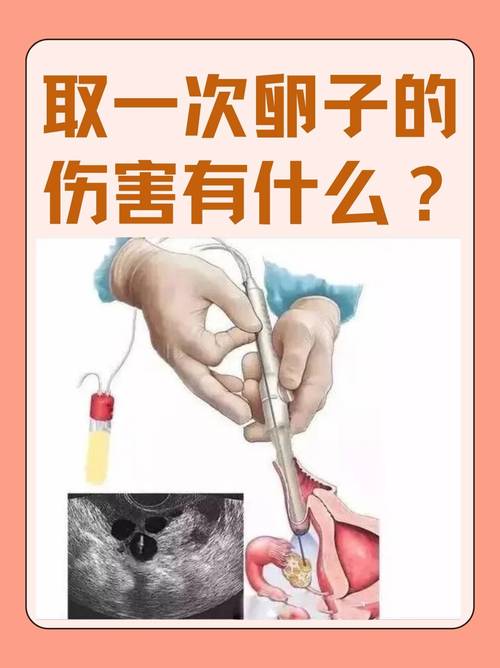 重庆取卵麻醉到底疼不疼 会不会影响卵子质量 医生一次说清