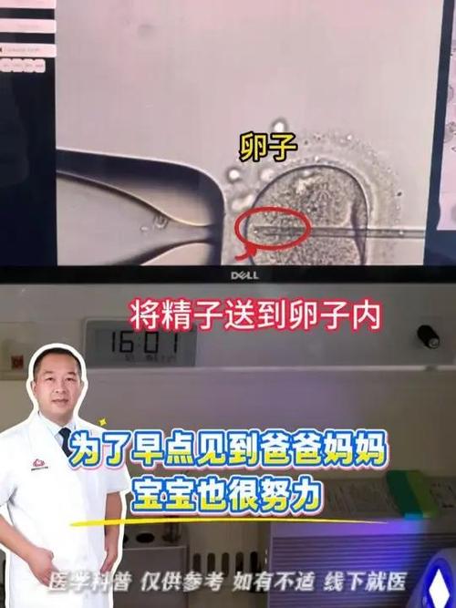 重庆二代试管原理详解 卵胞浆内单精子注射如何助孕