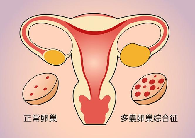 重庆HIV治疗后到底能不能生孩子？感染者生育指南