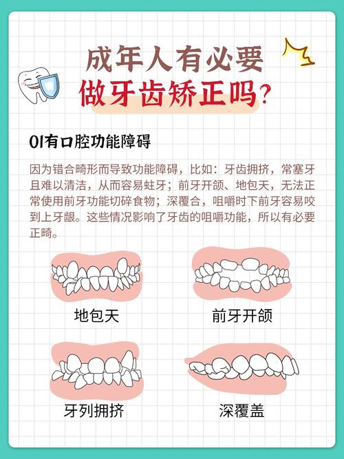 重庆20岁还能矫正牙齿吗？成年人矫正前必看这几点