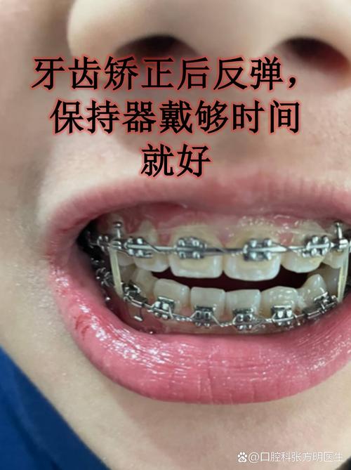 重庆40多岁做牙齿矫正,晚不晚?效果好吗?