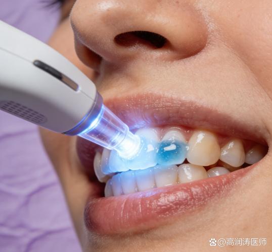 重庆牙齿冷光美白价格全解：从几百到上万怎么定