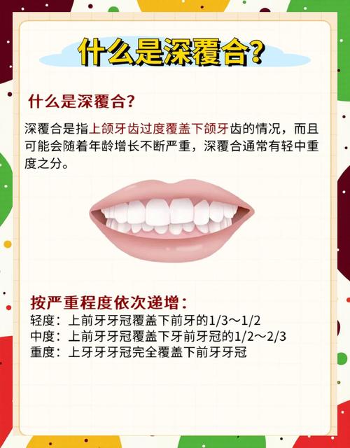 牙齿矫正后还是深覆合_30岁后还能不能矫正牙齿深覆合_覆盖牙齿矫正